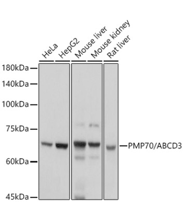 PMP70/ABCD3 Rabbit Polyclonal Antibody