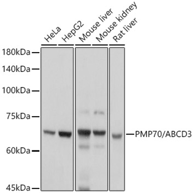 PMP70/ABCD3 Rabbit Polyclonal Antibody