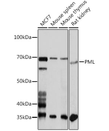 PML Rabbit Polyclonal Antibody