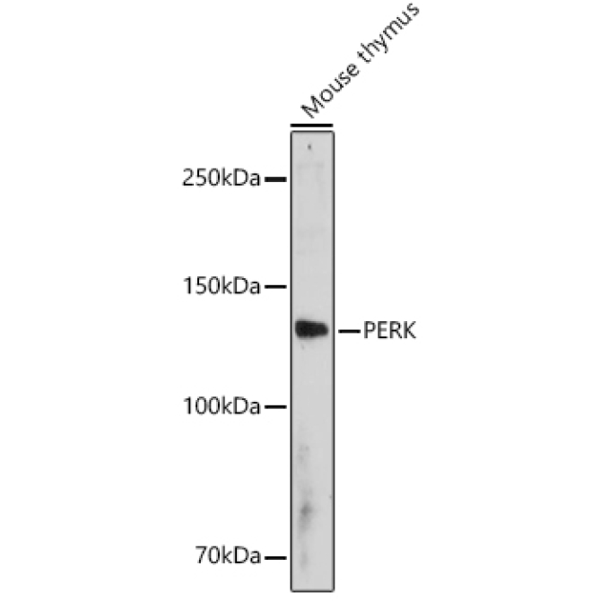 PERK Rabbit Polyclonal Antibody