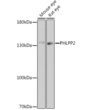 PHLPP2 Rabbit Polyclonal Antibody