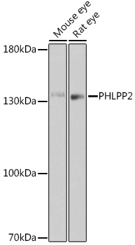 PHLPP2 Rabbit Polyclonal Antibody
