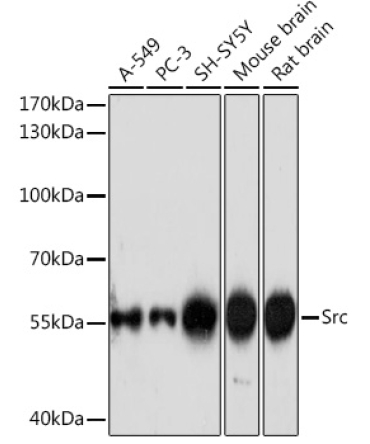 Src Rabbit Polyclonal Antibody