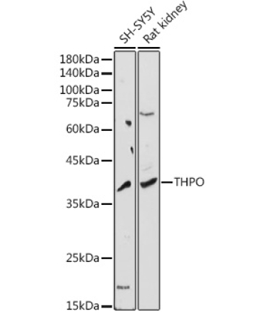 THPO Rabbit Polyclonal Antibody