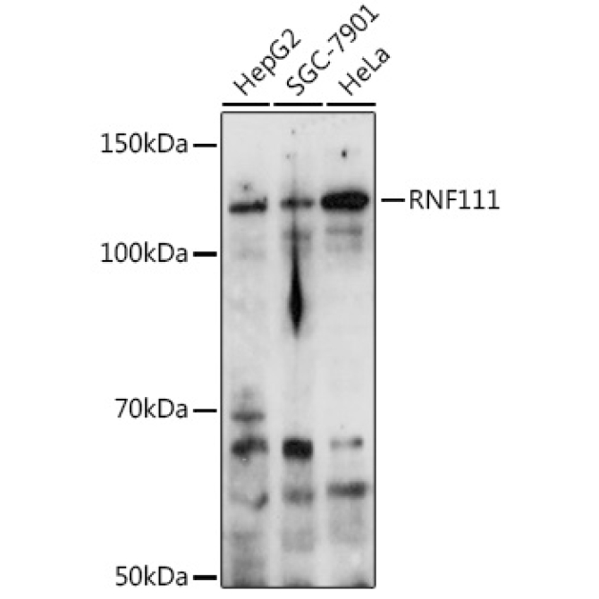 RNF111 Rabbit Polyclonal Antibody
