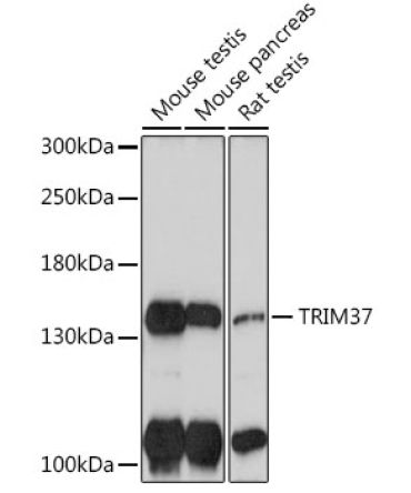 TRIM37 Rabbit Polyclonal Antibody