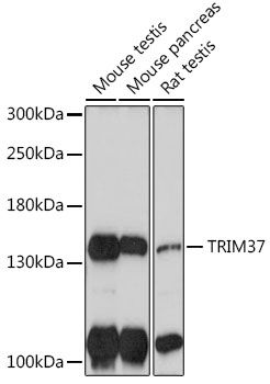 TRIM37 Rabbit Polyclonal Antibody