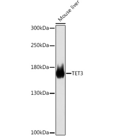TET3 Rabbit Polyclonal Antibody