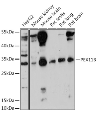PEX11B Rabbit Polyclonal Antibody