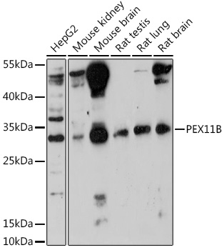 PEX11B Rabbit Polyclonal Antibody