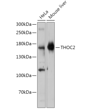 THOC2 Rabbit Polyclonal Antibody