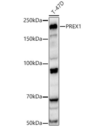 PREX1 Rabbit Polyclonal Antibody