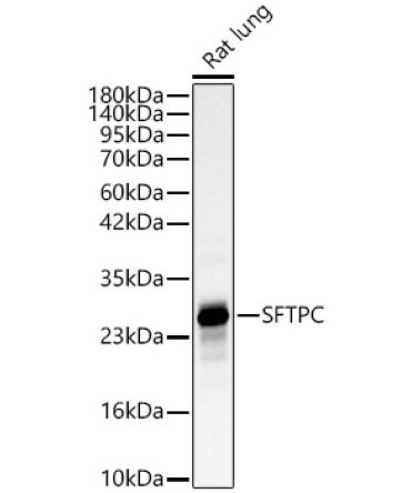 SFTPC Rabbit Polyclonal Antibody