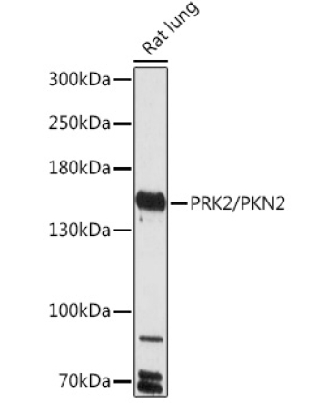 PRK2/PKN2 Rabbit Polyclonal Antibody