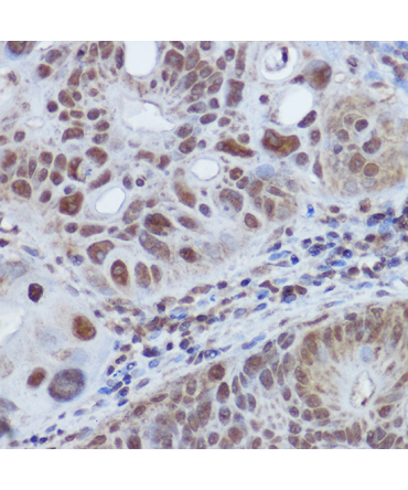 RBMY1A1 Rabbit Polyclonal Antibody