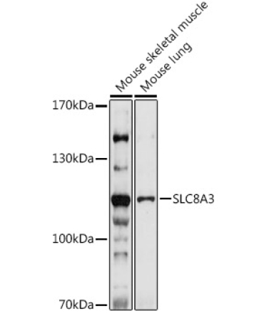 SLC8A3 Rabbit Polyclonal Antibody
