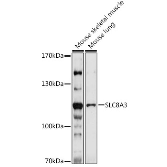 SLC8A3 Rabbit Polyclonal Antibody