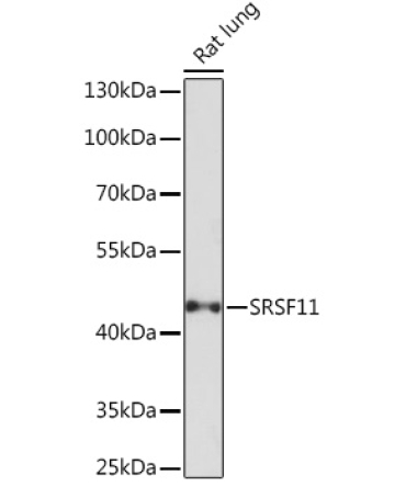SRSF11 Rabbit Polyclonal Antibody