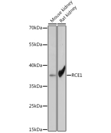 RCE1 Rabbit Polyclonal Antibody