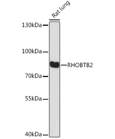 RHOBTB2 Rabbit Polyclonal Antibody