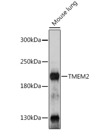 TMEM2 Rabbit Polyclonal Antibody