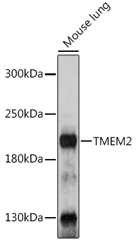 TMEM2 Rabbit Polyclonal Antibody