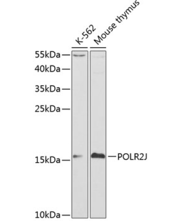 POLR2J Rabbit Polyclonal Antibody