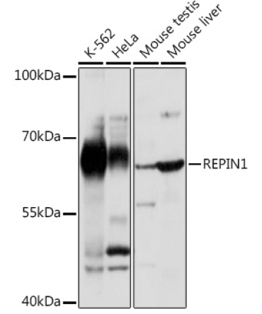 REPIN1 Rabbit Polyclonal Antibody