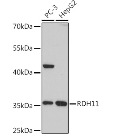 RDH11 Rabbit Polyclonal Antibody