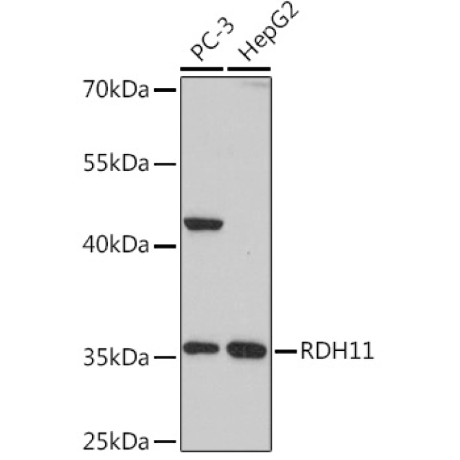 RDH11 Rabbit Polyclonal Antibody
