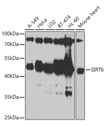 SIRT6 Rabbit Polyclonal Antibody