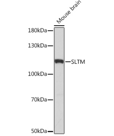 SLTM Rabbit Polyclonal Antibody
