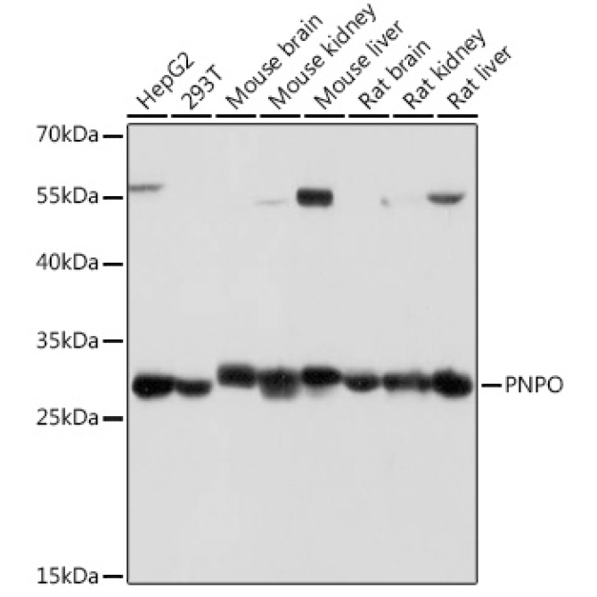 PNPO Rabbit Polyclonal Antibody