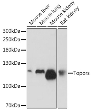 Topors Rabbit Polyclonal Antibody