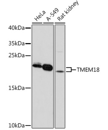TMEM18 Rabbit Polyclonal Antibody