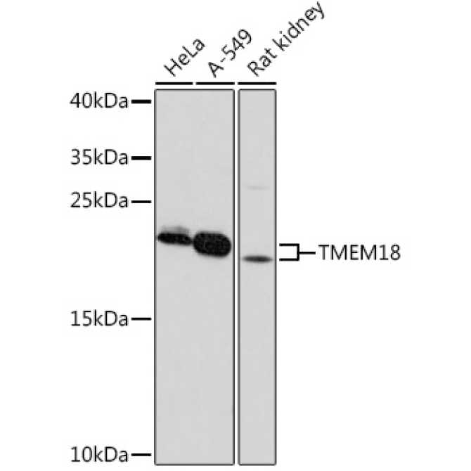 TMEM18 Rabbit Polyclonal Antibody