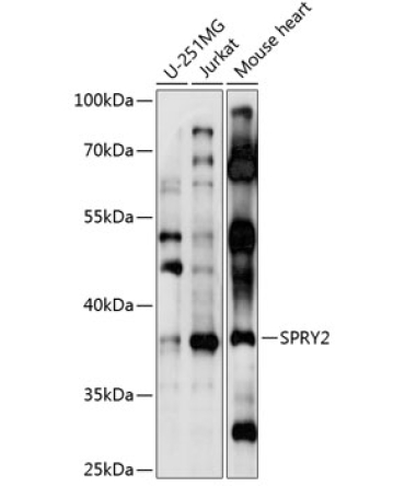 SPRY2 Rabbit Polyclonal Antibody