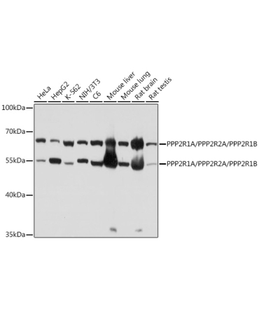 PPP2R1A/PPP2R2A/PPP2R1B Rabbit Polyclonal Antibody