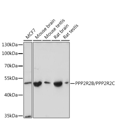 PPP2R2B/PPP2R2C Rabbit Polyclonal Antibody