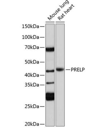 PRELP Rabbit Polyclonal Antibody