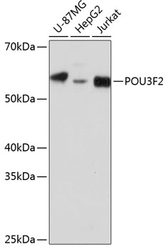 POU3F2 Rabbit Polyclonal Antibody