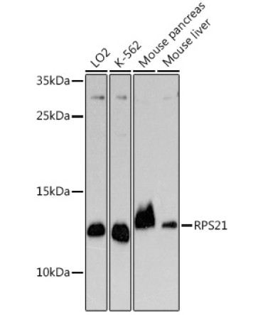 RPS21 Rabbit Polyclonal Antibody