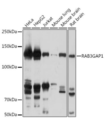 RAB3GAP1 Rabbit Polyclonal Antibody