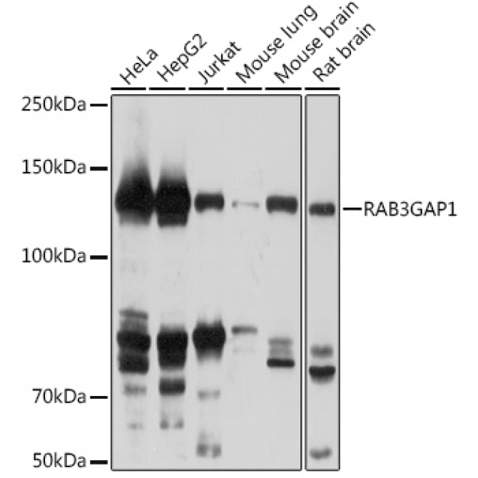 RAB3GAP1 Rabbit Polyclonal Antibody