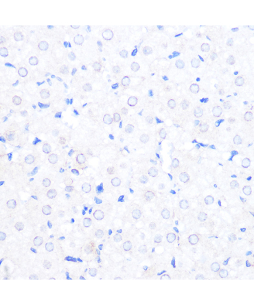 RANBP2 Rabbit Polyclonal Antibody