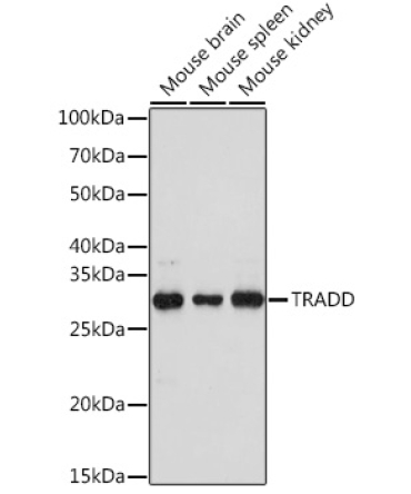 TRADD Rabbit Polyclonal Antibody