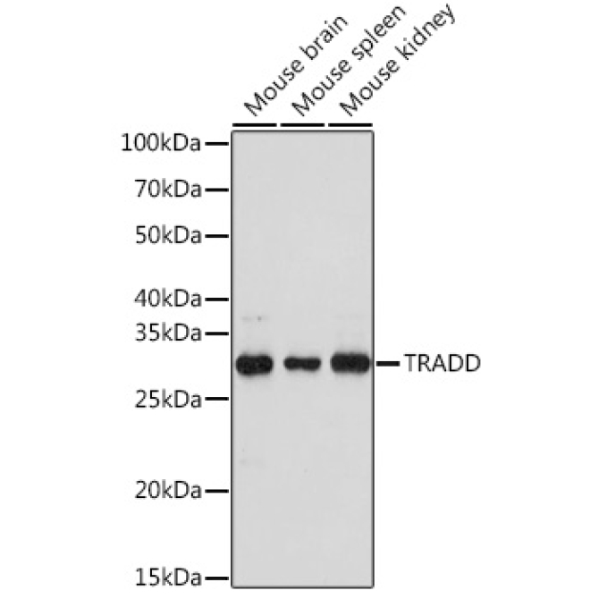 TRADD Rabbit Polyclonal Antibody