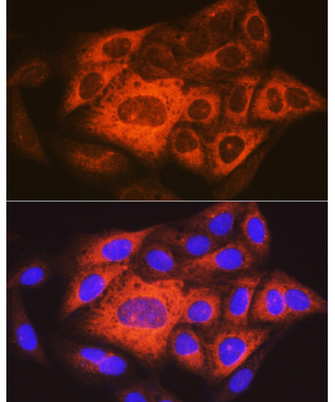 TACC3 Rabbit Polyclonal Antibody