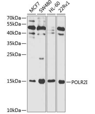 POLR2I Rabbit Polyclonal Antibody