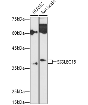 Siglec-15 Rabbit Polyclonal Antibody